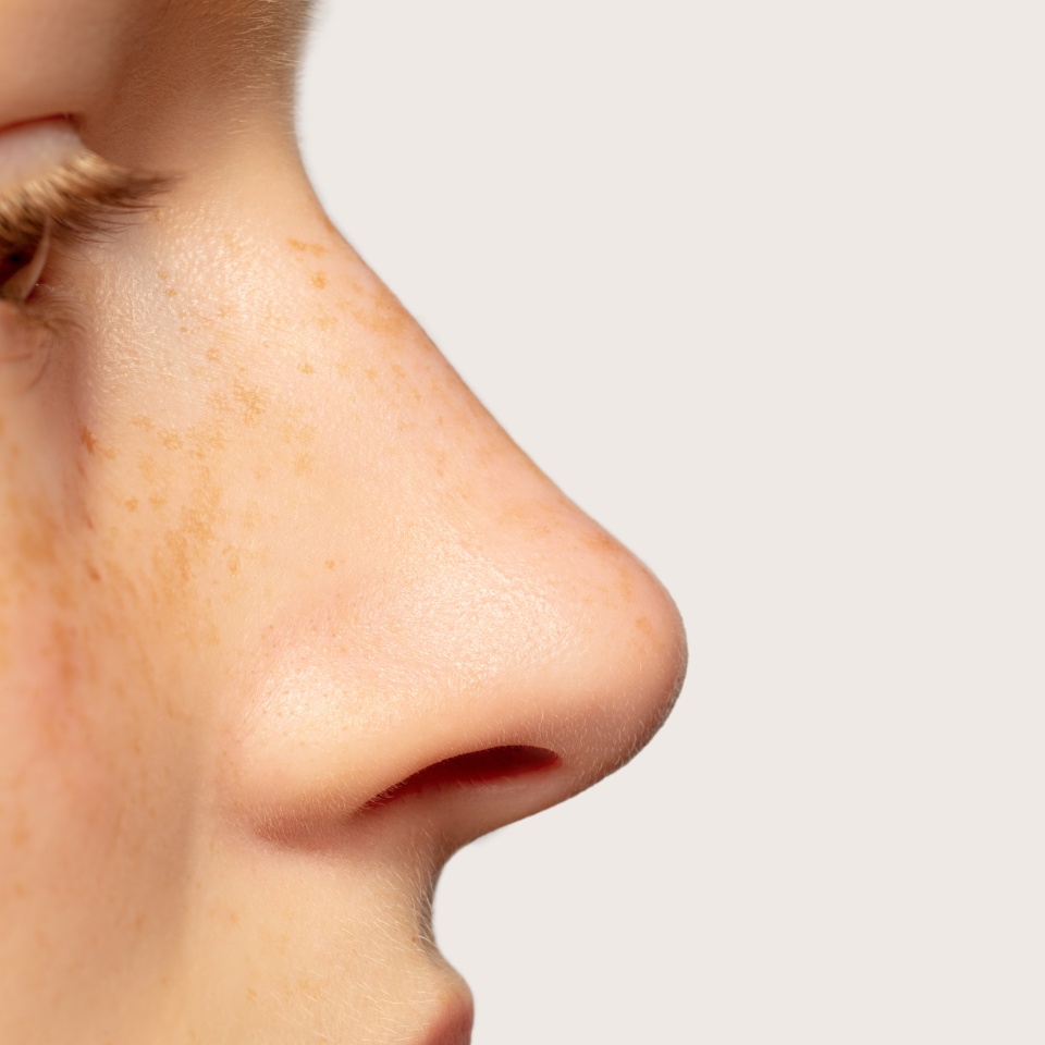 Profile nose, flyer. Close up portrait of beautiful redhair caucasian female model. Parts of face. Beauty, fashion, skincare, cosmetics, wellness concept. Copyspace. Well-kept skin, fresh look